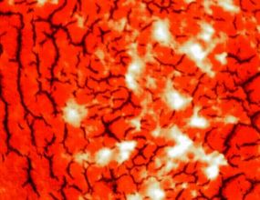 droog bloed analyse als scan voor verstoringen in het bloed