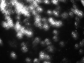 droog bloed analyse als scan voor verstoringen in het bloed