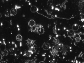 levend bloed analyse voor het herkennen van stofwisselings- en immuunsystemen