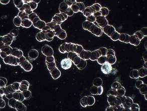 levend bloed analyse voor het herkennen van stofwisselings- en immuunsystemen